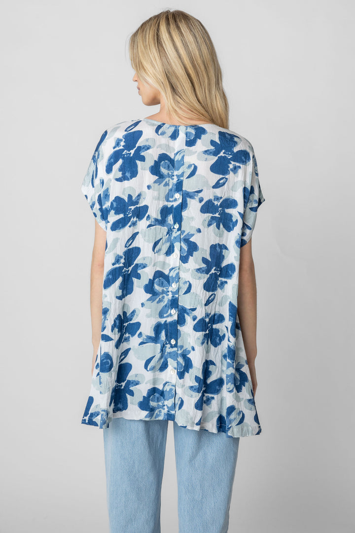 Florian Print Button Back Tunic